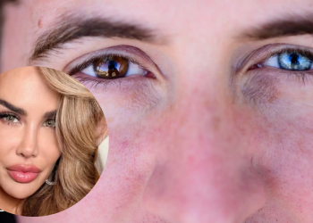 La Ciencia Y El Riesgo Detrás De La Cirugía De Cambio De Color De Ojos